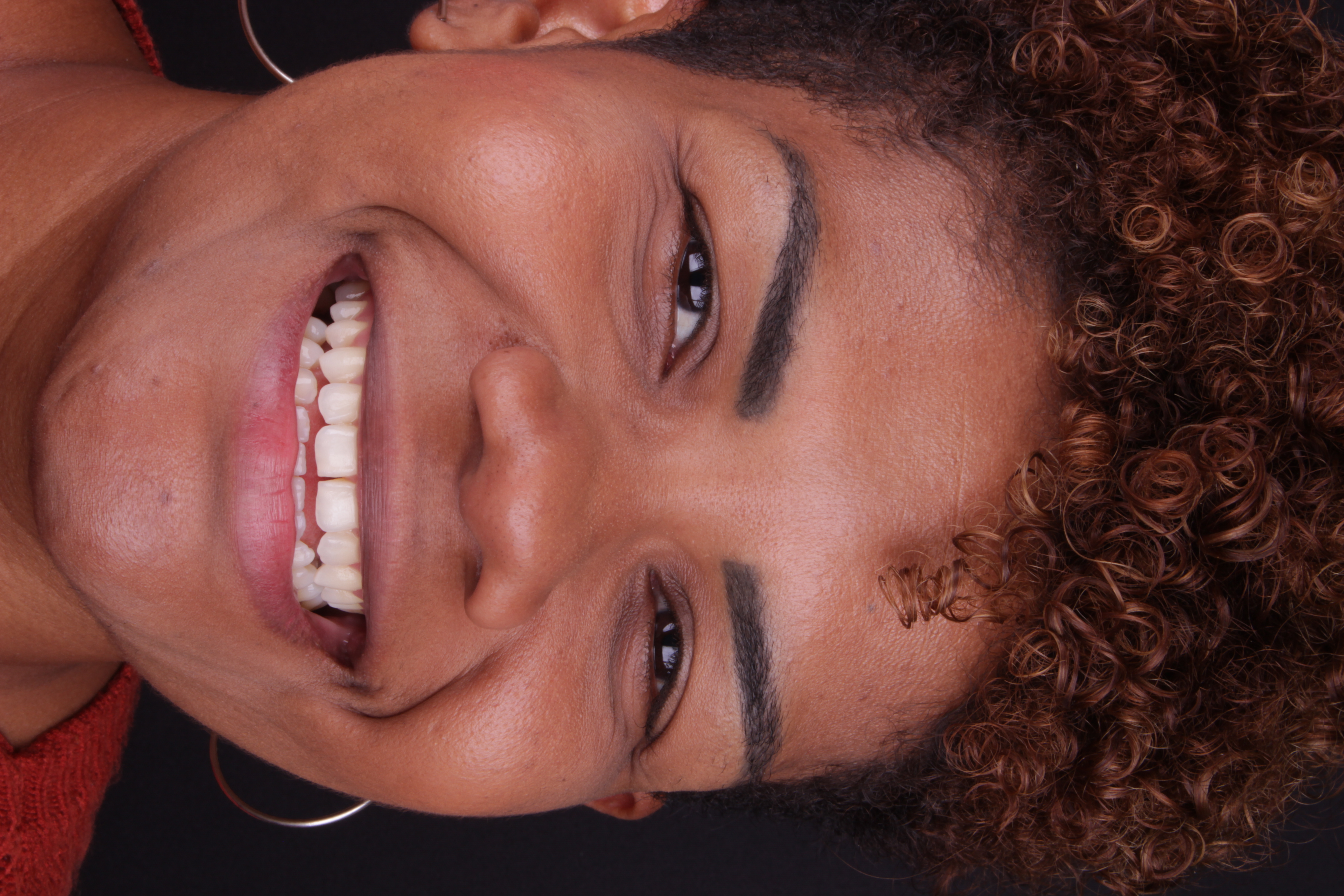 Sorriso antes da lente de contato dental — expressão espontânea