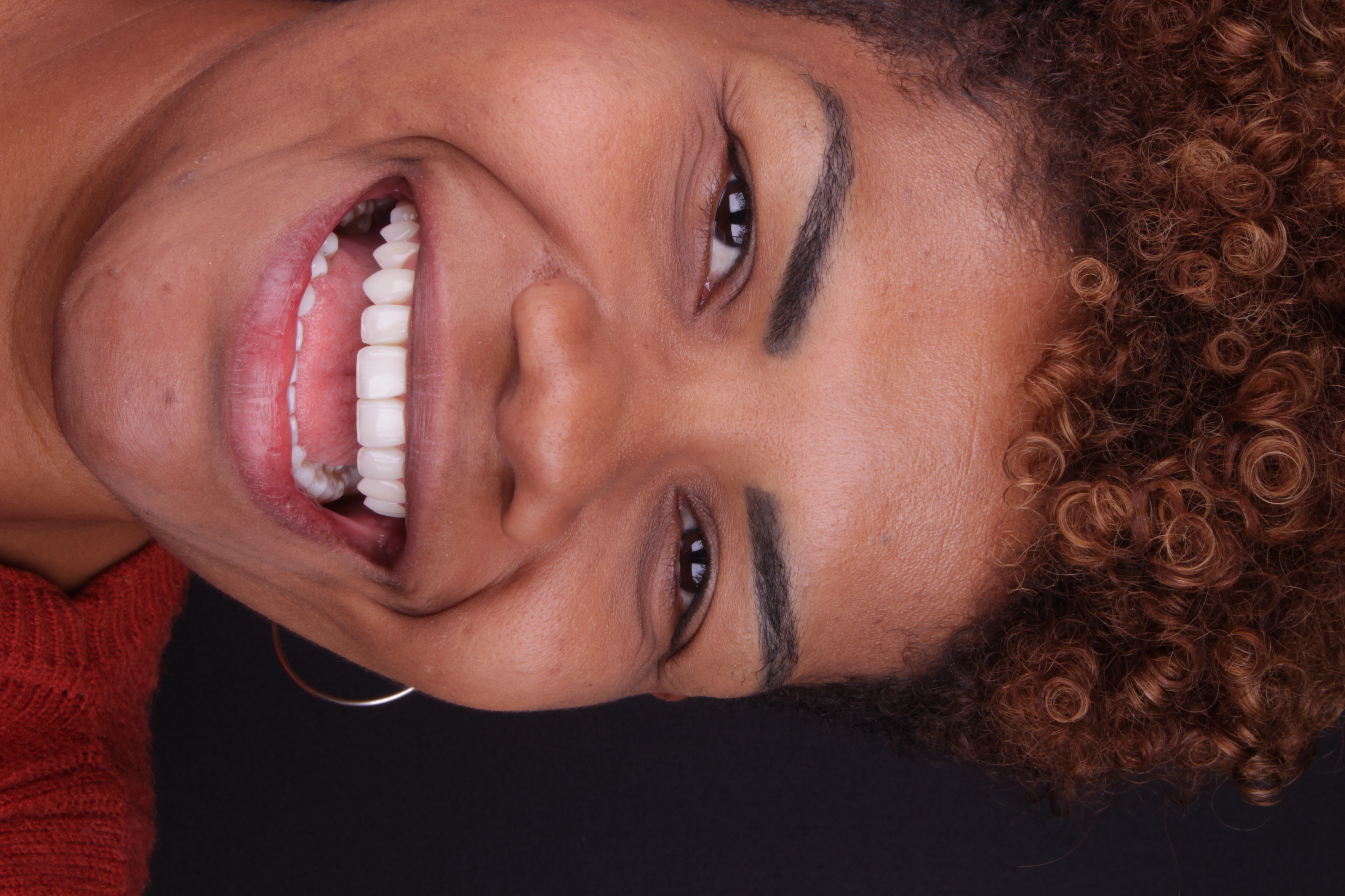 Sorriso depois da lente de contato dental — resultado natural e uniforme