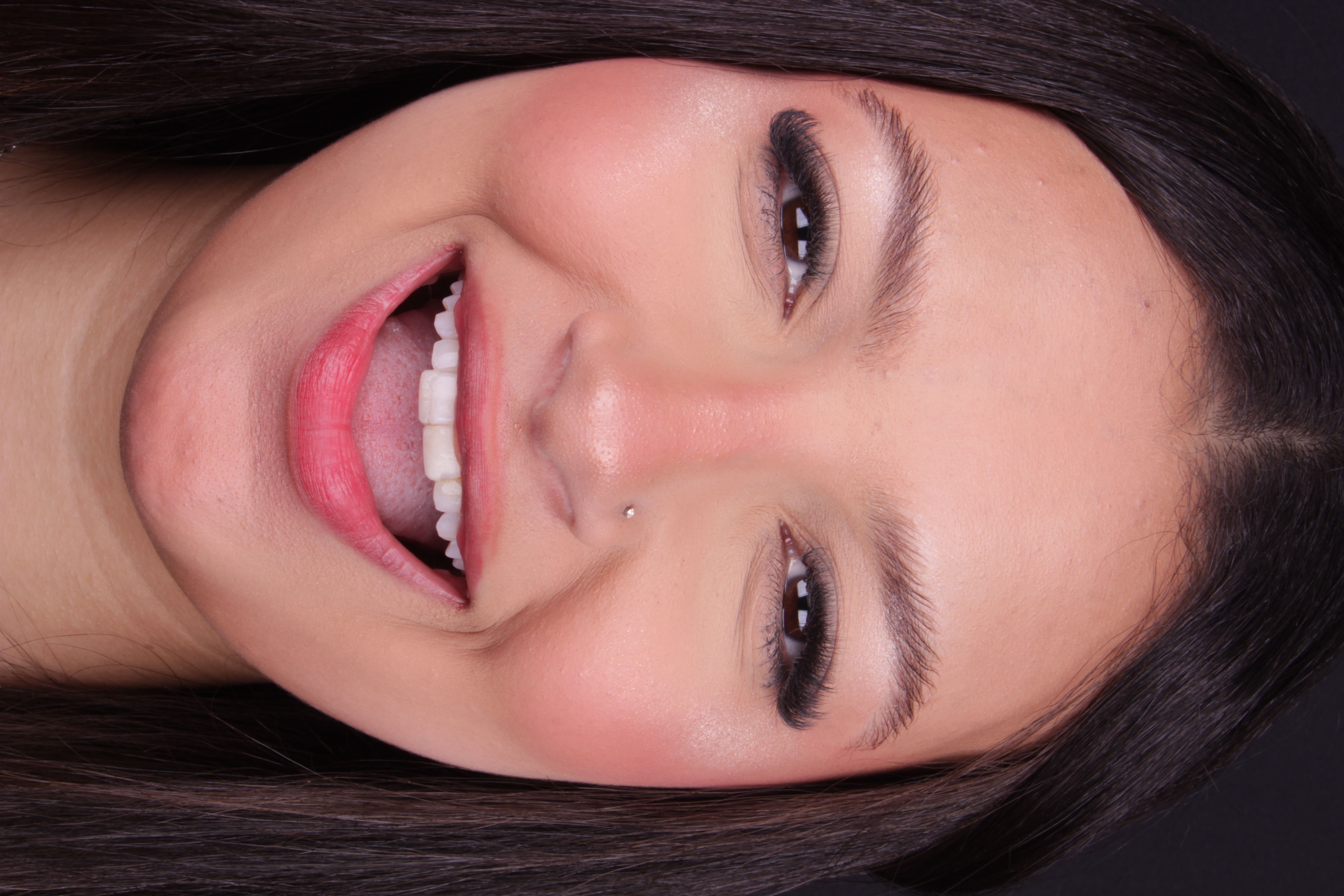 Sorriso antes da lente de contato dental — detalhe com colar