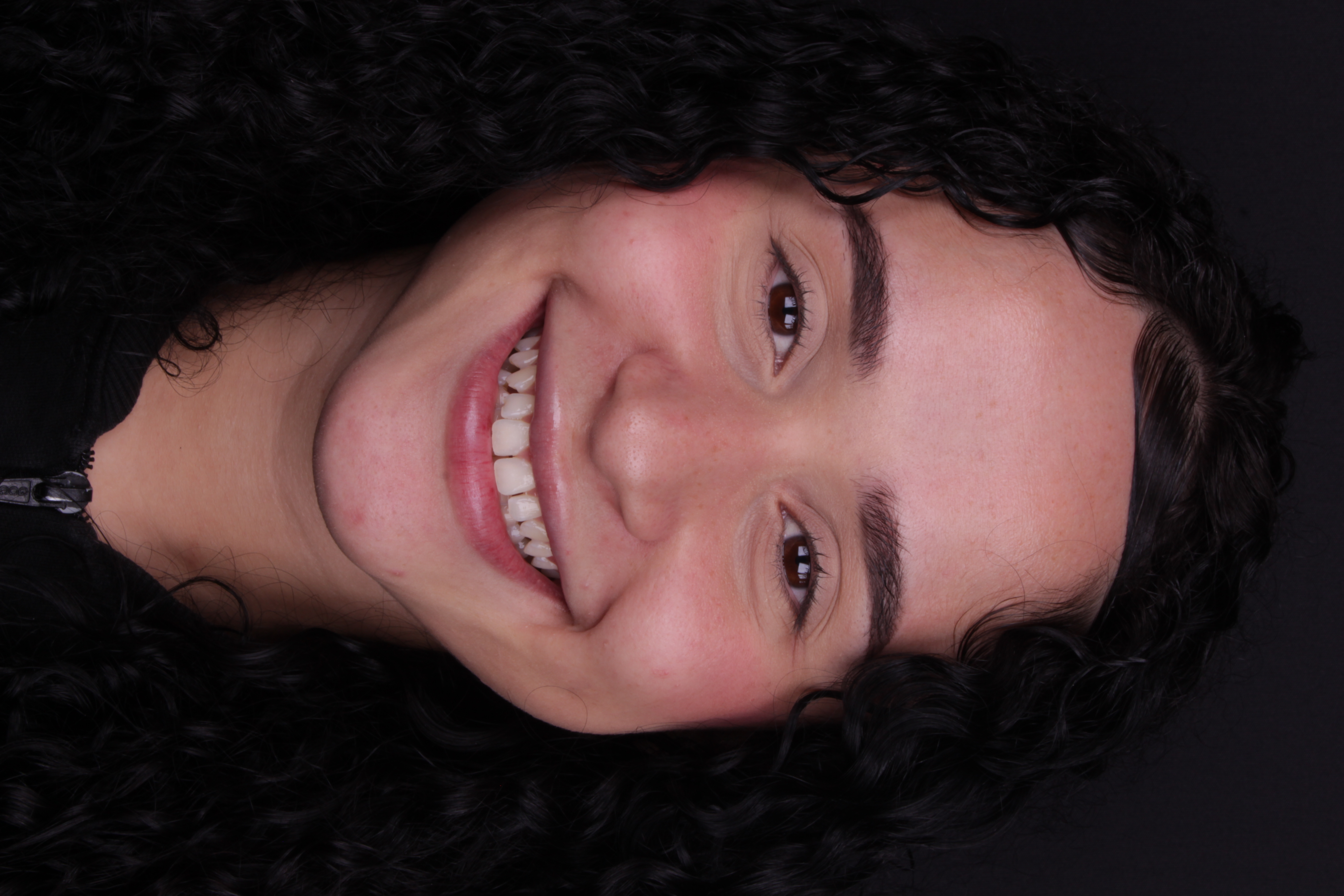 Sorriso depois da lente de contato dental — dentes alinhados e naturais